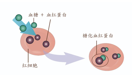 HbA1c≥6.5%——糖尿病診斷新標(biāo)準(zhǔn)